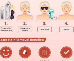 laser hair removal in Hyderabad