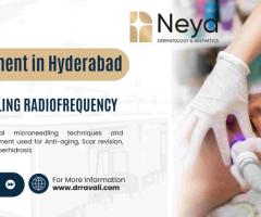 MNRF Treatment in Hyderabad