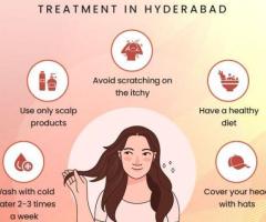 Dandruff Treatment in Hyderabad