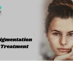 Pigmentation Treatment in Bangalore