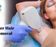 Laser Hair Removal Cost In Bangalore - Dr. Dixit Cosmetic Dermatology Clinic