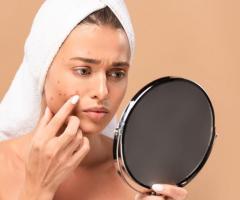 Acne Treatment in Ludhiana