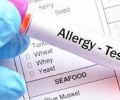 Allergy Test in Delhi - Book Your Appointment Now!