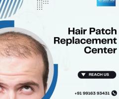 Hair Patch Repair & Replacement Center in Bangalore-Hair Glimmer