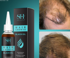 Sevich Hair Growth Black Oil In Pakistan Wellmart