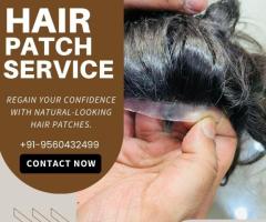 Hair Patch in Delhi – Natural Look Guaranteed