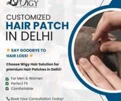 Customized Hair Patch in Delhi – Wigy Hair Solution